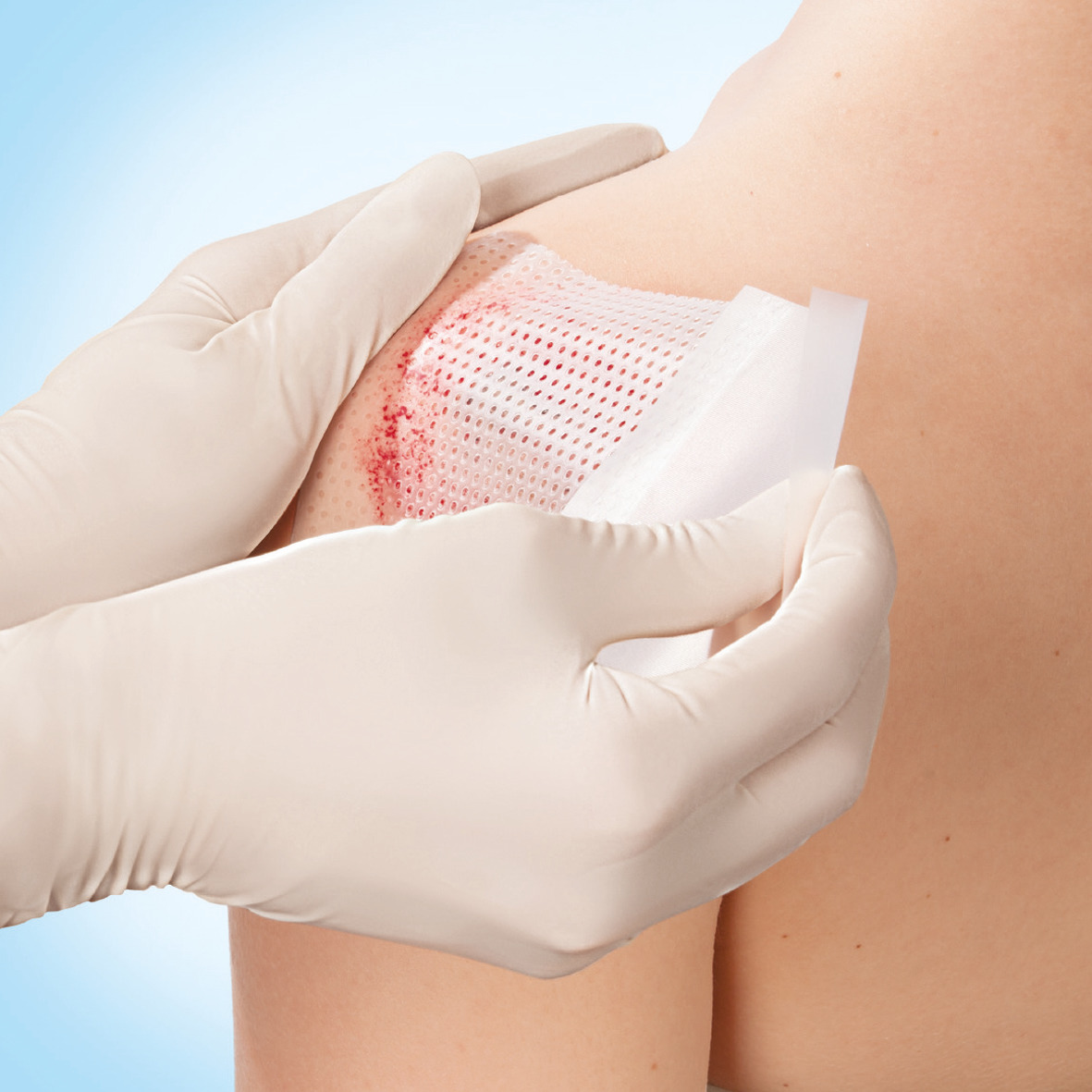 BSN Leukoplast cuticell contact - sterile Silikonwundauflage mit spezieller Lochstruktur
