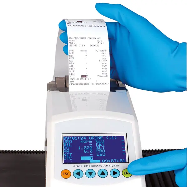 Preview: Analysegerät Servotest Reader für Urinteststreifen - Mit eingebautem Thermodrucker 