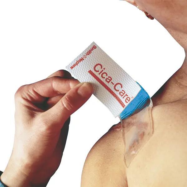 Cica-Care Silikongel-Verband