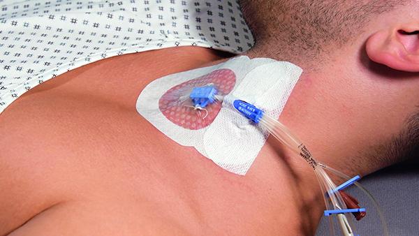 Preview: Curafix i.v. Control, Lohmann & Rauscher - Fixierpflaster mit transparentem Sichtfenster (SSB-fähig)