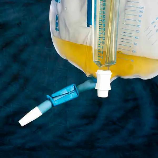 Curity Urinmessgeräte - Urinmessung im geschlossenen System, Messkammer 400 ml Kapazität