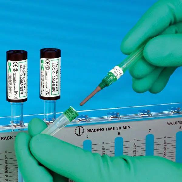 Preview: ESR Vakuumröhrchen für die Blutsenkung nach Westergren