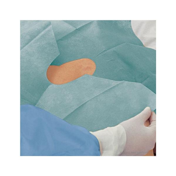 Foliodrape Protect Lochtücher steril selbstklebend 2lagig variabel