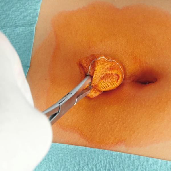 Preview: Hartmann Cutasept G -  Gefärbtes Hautantiseptikum 1 Liter Flasche  (SSB-fähig)