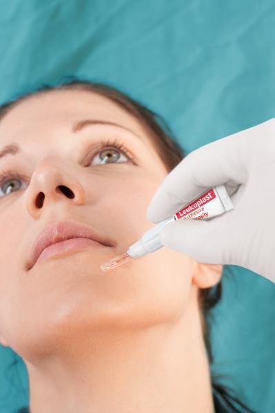 Preview: Leukoplast Skin Adhesive Hautkleber - 10 Dosiertuben mit 2-in-1 Applikator (SSB-fähig)