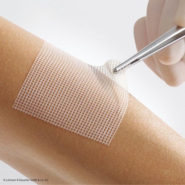 Preview: Lomatuell Pro, Lohmann & Rauscher - Gelbildende Wundauflage mit offener Netzstruktur (SSB-fähig)