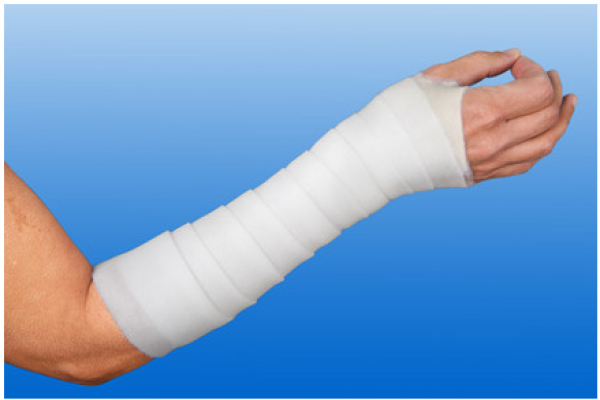 Preview: Nobapad - Polsterbinden aus synthetischer Watte, 20 Stück (SSB-fähig)