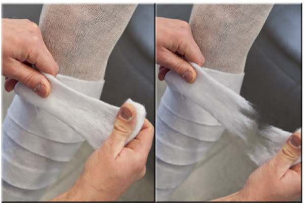 Preview: Nobapad - Polsterbinden aus synthetischer Watte, 20 Stück (SSB-fähig)