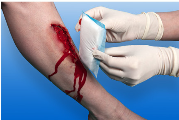 Preview: Nobasorb steril - Hochsaugfähige Wundkompressen (SSB-fähig)