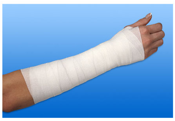 Preview: Nobatel Mittelzugbinde, steril - Leichte weiße Mittelzugbinde aus Mischgewebe (SSB-fähig)