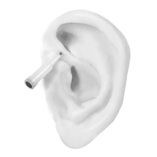 Preview: Ohr Akupunktur Dauernadeln ASP