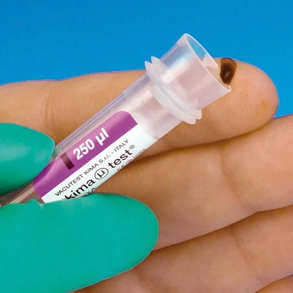 Paediatrie Blutprobengefäß EDTA-Beschichtet - Für Entnahme kleinster Kapillarblutmengen