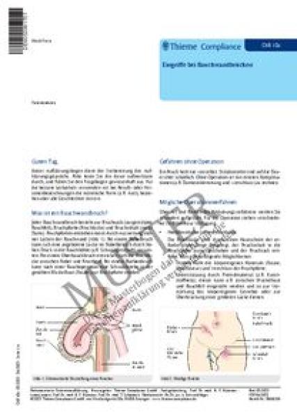 Patientenaufklärungsbögen, 50 Stück - Bauchwandbrüche, Eingriffe 
