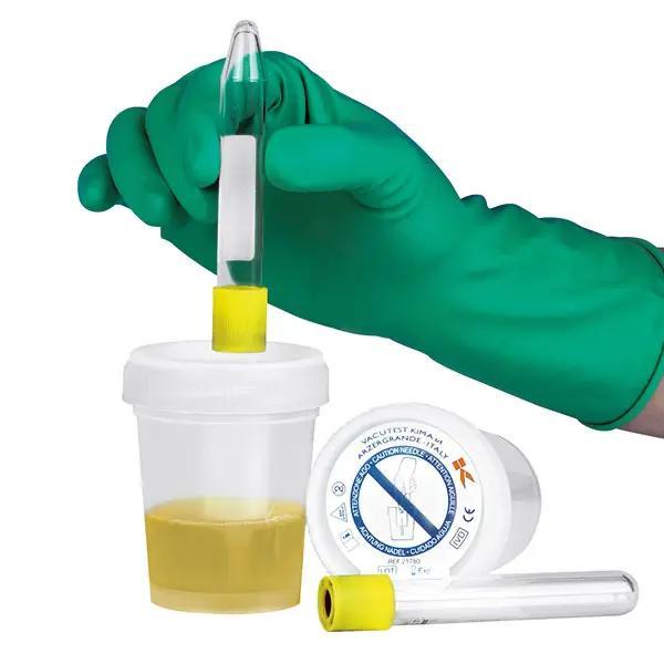 Preview: Sicherheits-Urinsammelsystem - Für die kontaminationsfreie Entnahme aus Uringefäßen