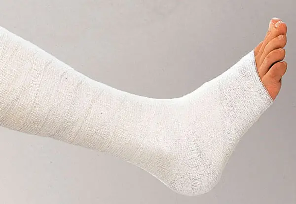 Preview: Varicex F (Feucht) - Zinkleimbinden zum Herstellen eines halbstarren Dauerverbandes