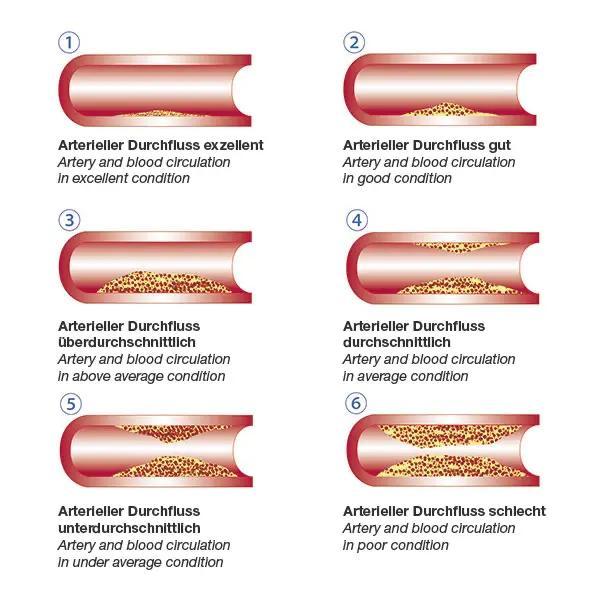 Preview: Vascular-Check Pulsoximeter - Anzeige von Sauerstoffsättigung, Puls und Phlethysmogramm 