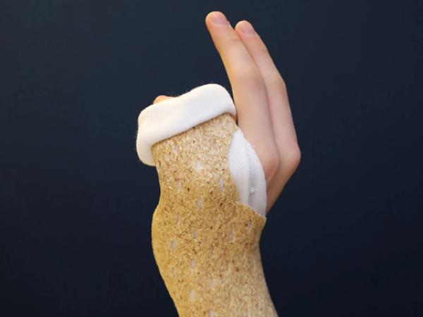 Woodcast Splint 4 mm - Stabile Frakturversorgung, ideal für Kinder - da hohe Belastbarkeit (SSB-fähig)