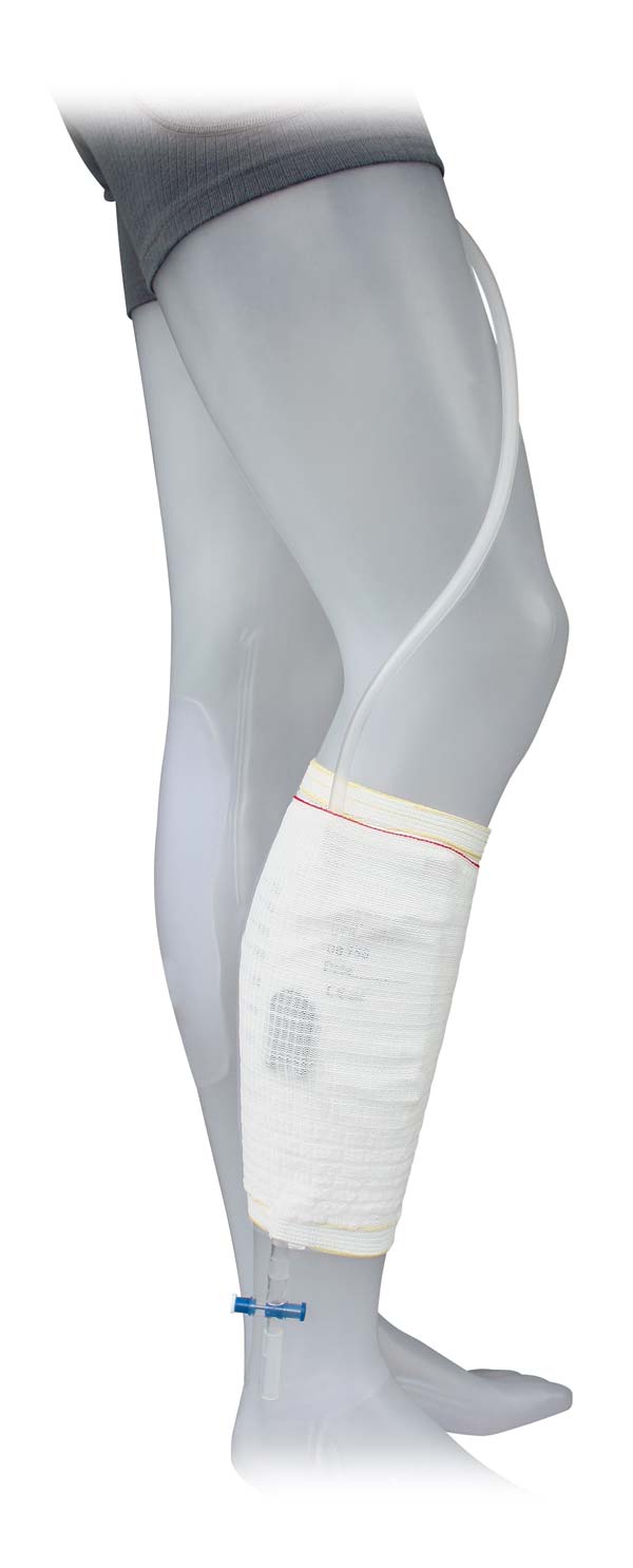 Beinbeutelfixierstrumpf mit integrierter Beinbeuteltasche & breitem seitl. Klettverschluss