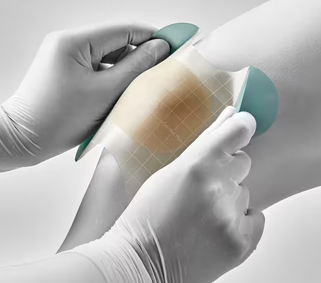 Comfeel Plus Contouriert, 6 x 8 cm - Hydrokolloidverbände für die feuchte Wundheilung