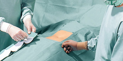 Foliodrape Protect Basis-Set III - 10 Sets für abdominale Eingriffe der Allgemeinchirurgie