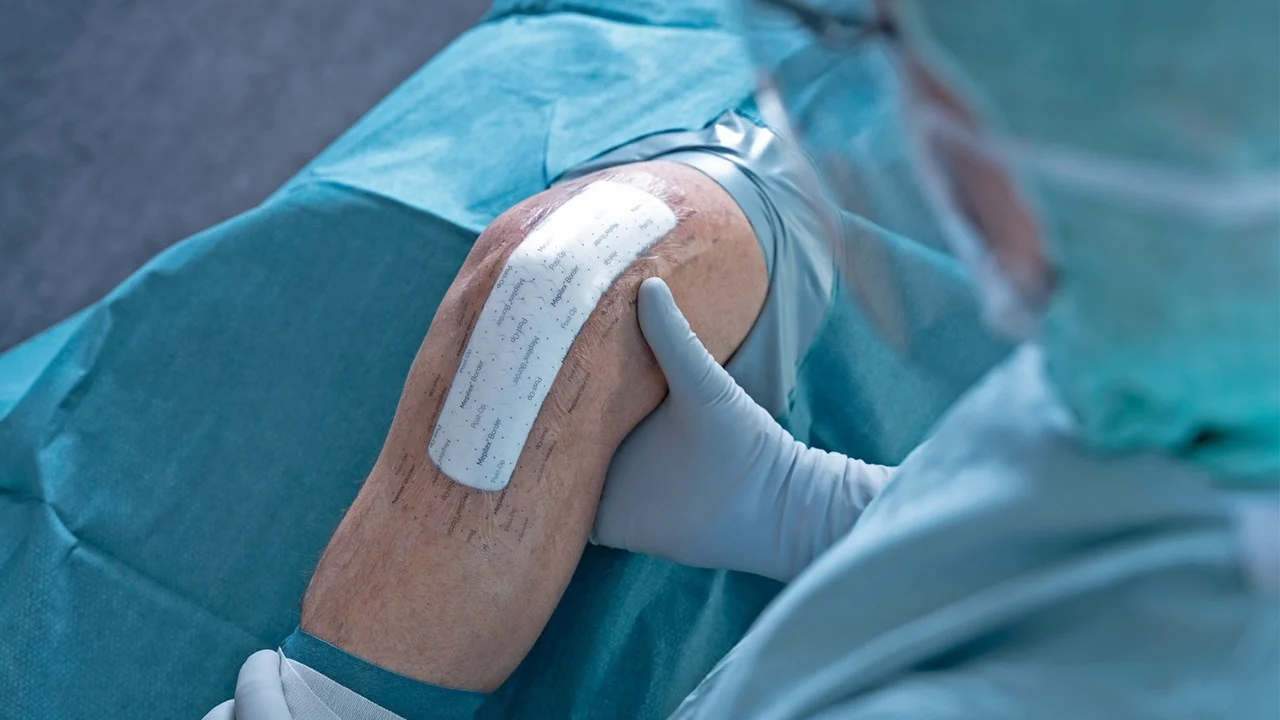 Mepilex Border Post-OP - Flexibler Komplettverband für chirurgische Wunden, steril (SSB-fähig)