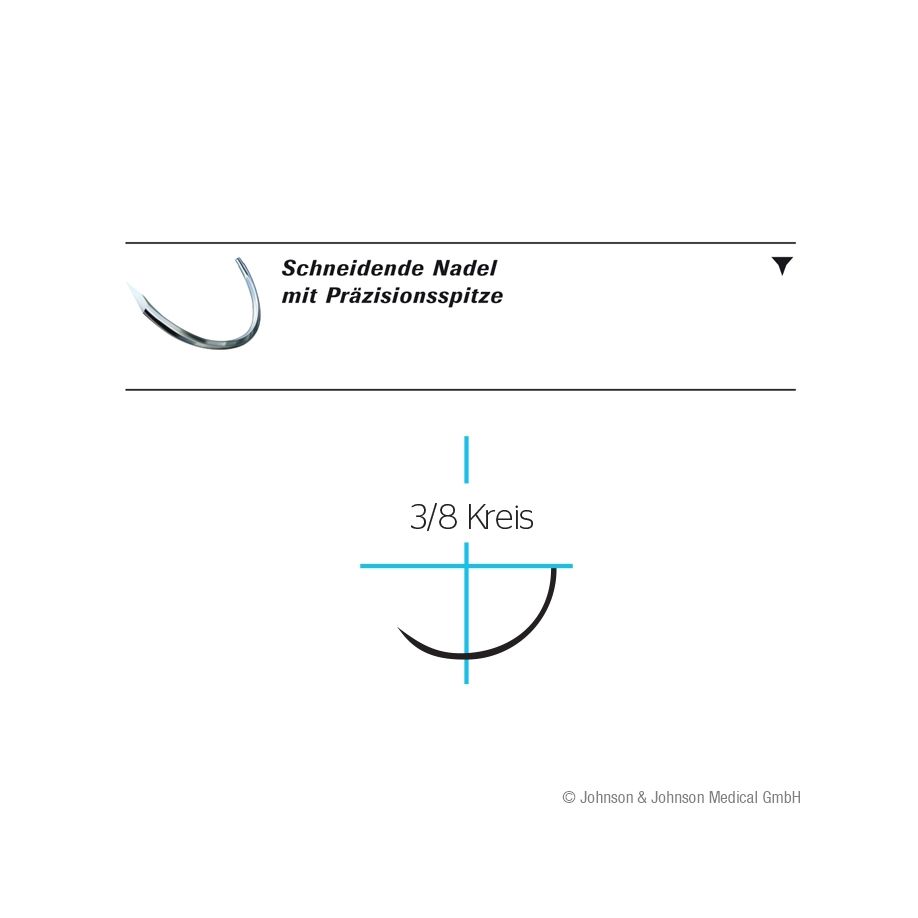 Monocryl plus PS2 Multipass 1,5=4/0 - 3Dtzd, ungefärbt, monofil, Nahtmaterial resorbierbar (SSB-fähig)