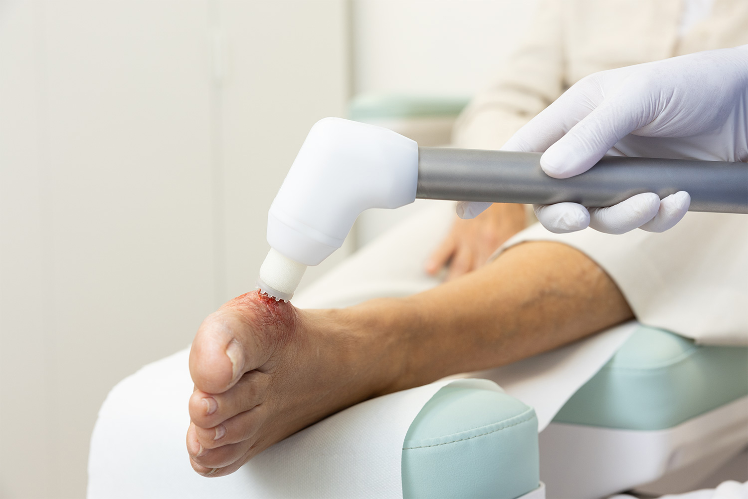 PlasmaDerm Universal Flex Gerät inkl. Cutan Handgriff - Kaltplasma-Therapie 