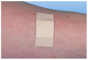 RUDAMED soft - Wundschnellverband für empfindliche Haut (SSB-fähig)