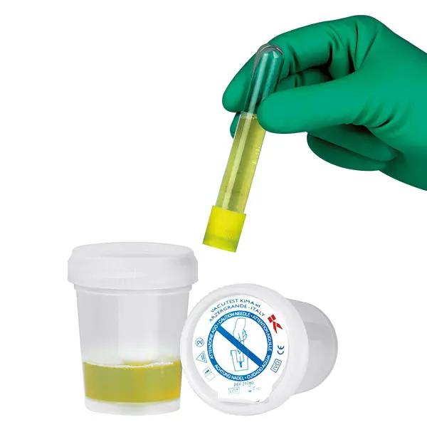 Sicherheits-Urinsammelsystem - Für die kontaminationsfreie Entnahme aus Uringefäßen