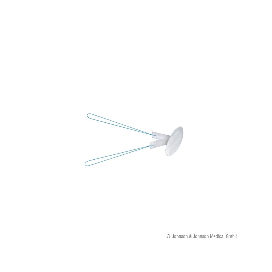 PROCEED Ventral Patch - Steriles Einweg-Produkt, Versorgung von Hernien